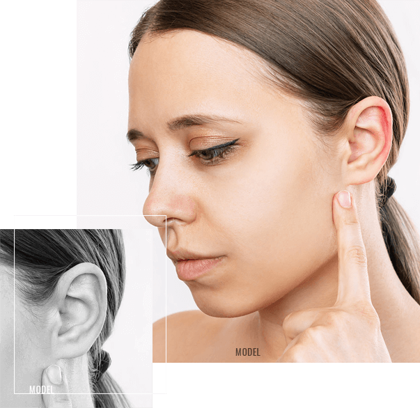 ear-surgery-1