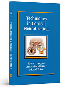 TECHNIQUES IN CORNEAL NEUROTIZATION Book