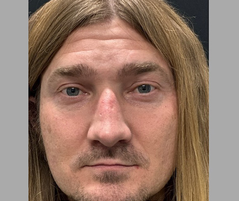 42 year old male 7 months after rhinoplasty 42 year old male 7 months after rhinoplasty