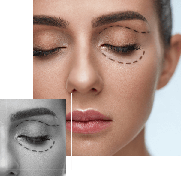 image of Woman With Closed Eyes And Black Surgical Lines On Skin image of Woman With Closed Eyes And Black Surgical Lines On Skin